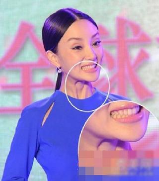 李小璐整容失败巩俐胸部下垂 女星装嫩大出丑(图)