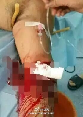 河南南阳 社旗发生恶性斗殴 事件 现场惨不忍睹