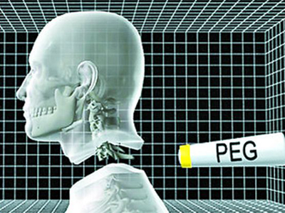 全球首例换头手术志愿者:我没疯 希望寻求支持