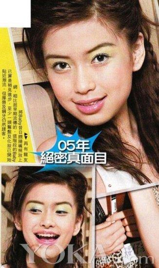 baby被建议做面部鉴定 揭angelababy整容前后对比照