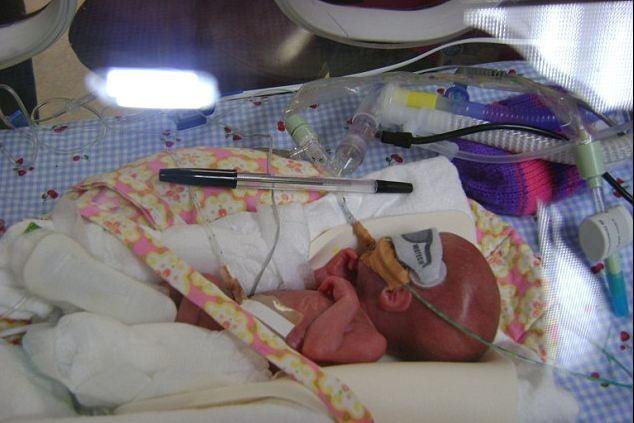 早产儿有哪些危险 早产儿会发生什么问题