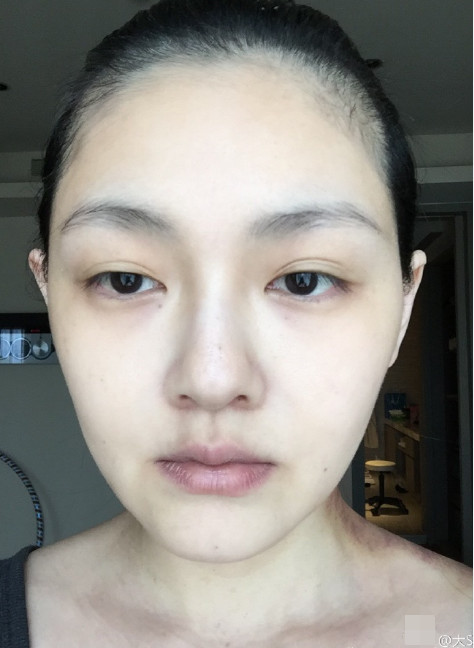 大s罕见晒面部纯素颜特写 可是脖子上怎么了?