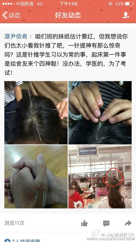 一名女医学生头顶扎着针复习的照片刷爆朋友圈,但对于这些学生而言