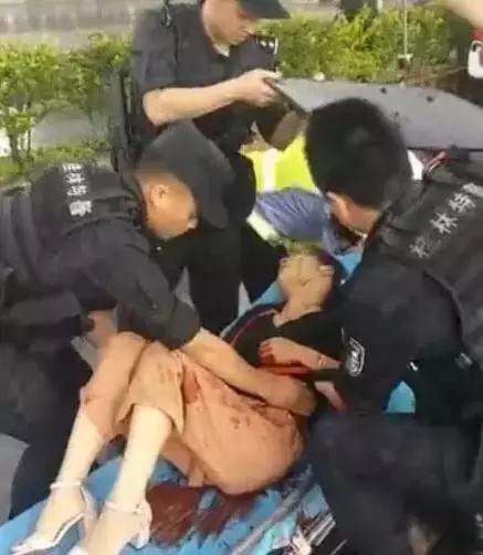 民警迅速赶到现场,发现一名身穿绿色衣服的女子坐在电动车上,腰腹部