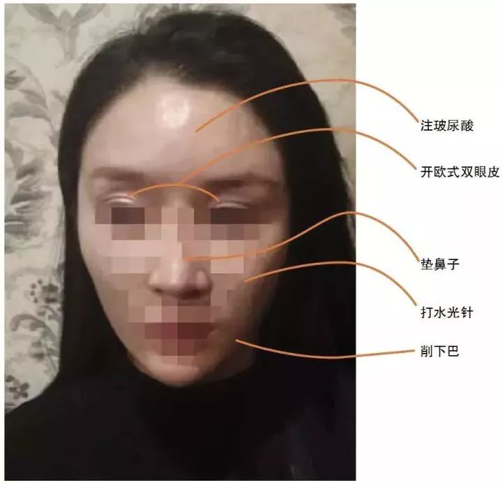 女子额头被老板砸了个坑 开口索赔10万