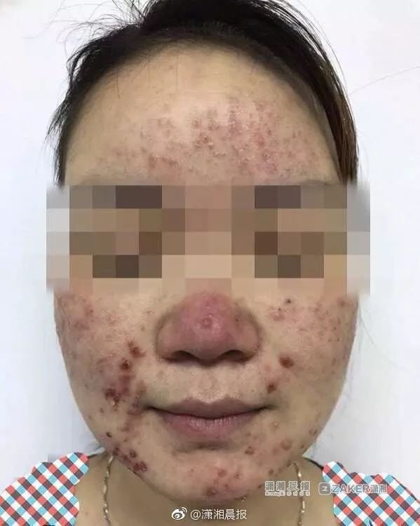 闻 | 北京电动车时速拟禁超15公里 儿童禁用柴胡注射液