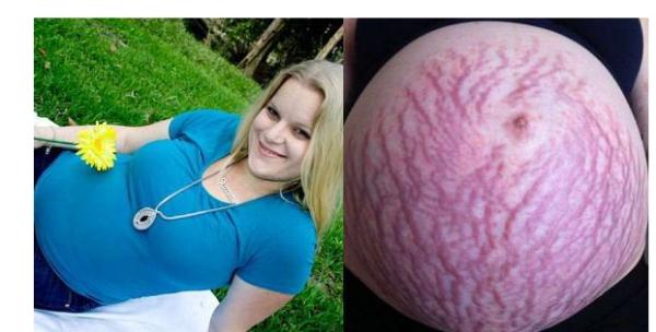 孕妇在孕晚期肚子疼怎么办?三种原因要知道,有