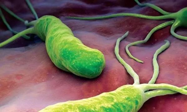 幽门螺杆菌最怕四种食物,长期坚持,四种胃病会离你更远! 幽门螺杆菌最怕四种食物,长期坚持,四种胃病会离你更远!