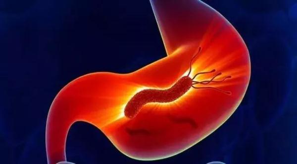 幽门螺杆菌最怕四种食物,长期坚持,四种胃病会离你更远! 幽门螺杆菌最怕四种食物,长期坚持,四种胃病会离你更远!