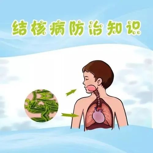 肺结核患者如何治疗?
