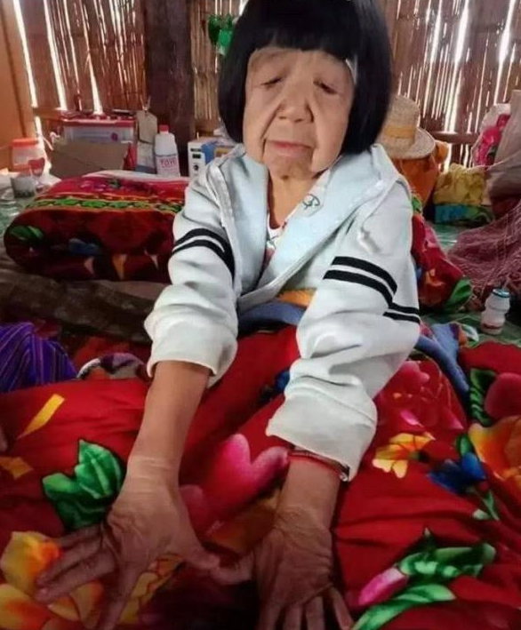 缅甸九岁村里盲女松弛,游戏百岁脸部女孩,老人变成生面貌图片