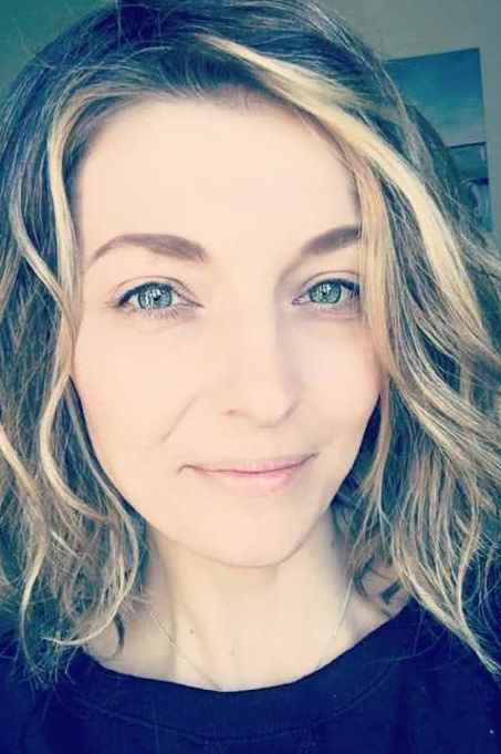 42岁女子因为压力太大导致头发脱落了90%,变