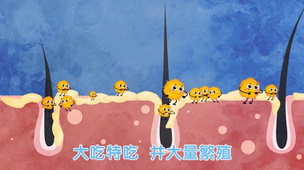 女子怕秃头3个月不洗,结果悲剧了 女子怕秃头3个月不洗,结果悲剧了