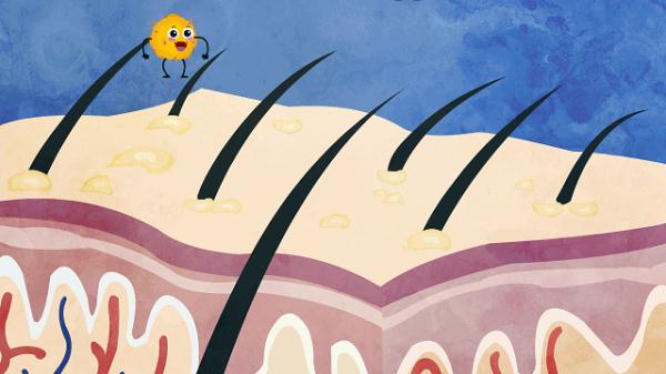 女子怕秃头3个月不洗,结果悲剧了 女子怕秃头3个月不洗,结果悲剧了