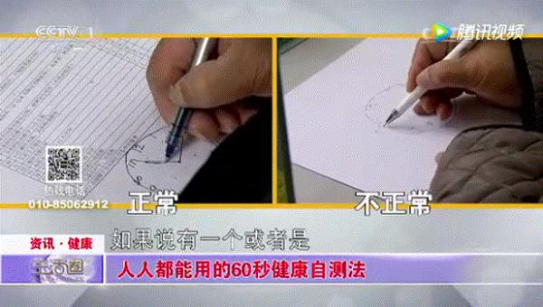 19岁男孩患阿尔茨海默症！老忘事？60秒自测