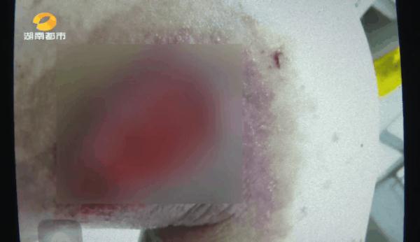 一个坏习惯，大火烧毁整个房间！