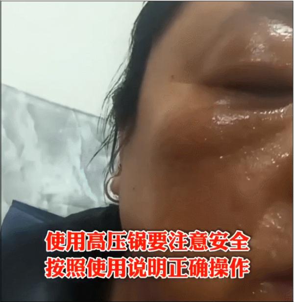 一声巨响传来，女子全身多处烫伤……许多人家里都有
