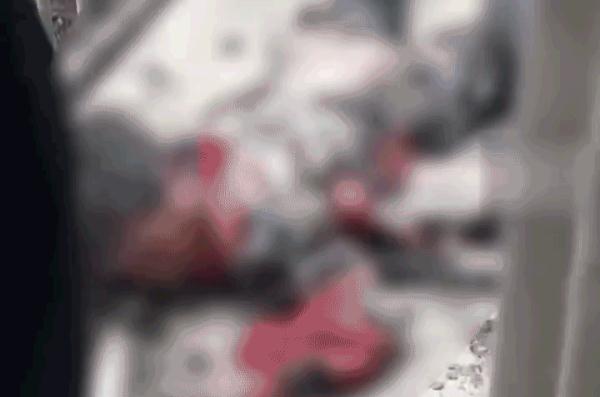 揪心！男童全身严重烧伤，只因这一动作……