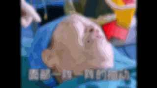 “眼皮跳”没重视,结果半边脸都…… “眼皮跳”没重视,结果半边脸都……