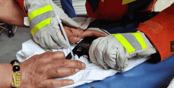 “蓝朋友”直奔医院，竟因一只老鼠？！