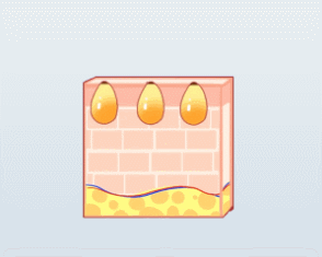 "身体缺啥脸上就长啥"真准吗?苦苦战"痘"的小伙伴快来看 → "身体缺啥脸上就长啥"真准吗?苦苦战"痘"的小伙伴快来看 →