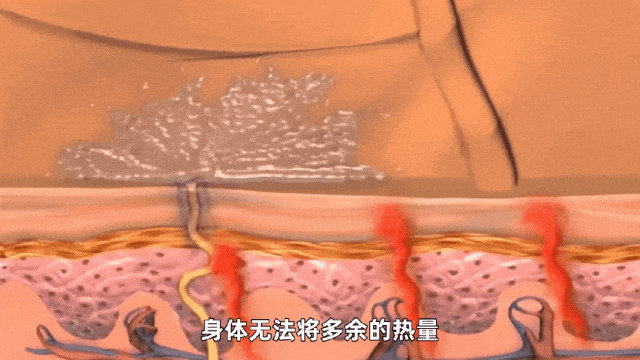 小心中暑!海口刚刚发布高温橙色预警→ 小心中暑!海口刚刚发布高温橙色预警→