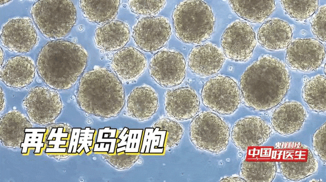 事关5亿人! “不死癌症”糖尿病的治疗终点,真的来了吗? 事关5亿人! “不死癌症”糖尿病的治疗终点,真的来了吗?