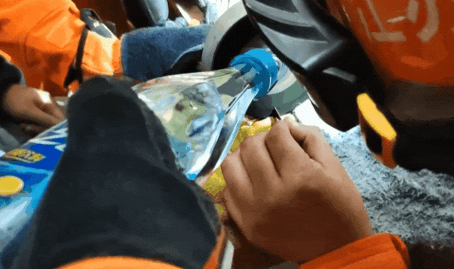 鸡毛毽子“下黑手”,男孩手指红肿告急! 鸡毛毽子“下黑手”,男孩手指红肿告急!