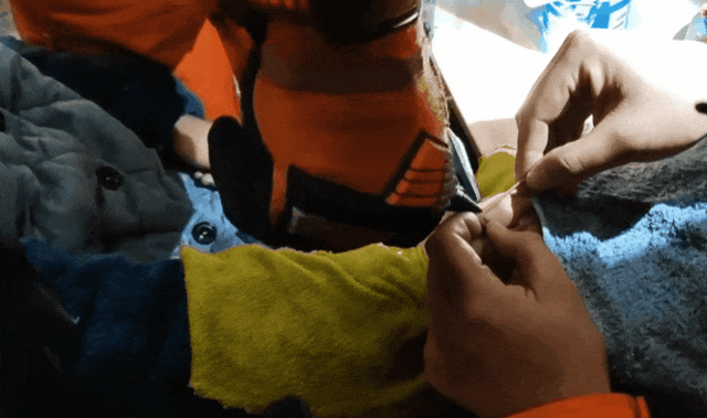 鸡毛毽子“下黑手”,男孩手指红肿告急! 鸡毛毽子“下黑手”,男孩手指红肿告急!