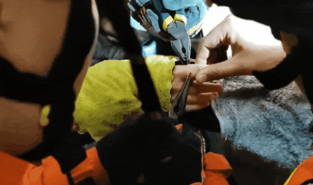 鸡毛毽子“下黑手”,男孩手指红肿告急! 鸡毛毽子“下黑手”,男孩手指红肿告急!