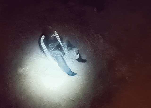 为张美照，两女孩各“失去”一条腿......