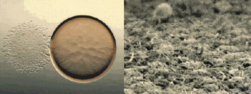 医生,揉眼睛居然有可能进ICU? 医生,揉眼睛居然有可能进ICU?