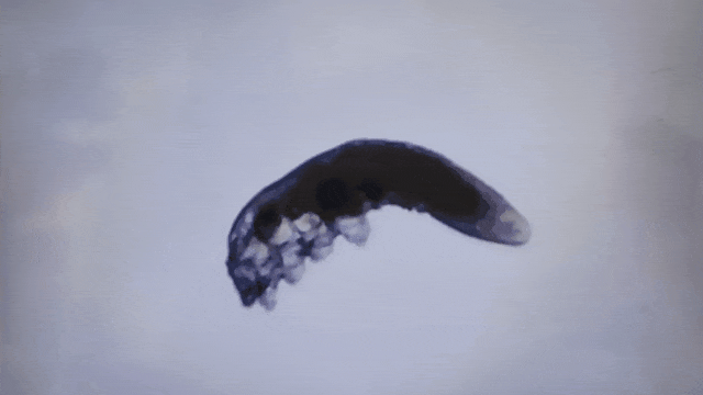 感觉眼睛总有异物，黏黏糊糊！做检查一看：是活的，还在爬……