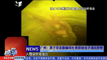 “始终还是中招了！”密密麻麻，广州阿叔在急诊科疼到受不了