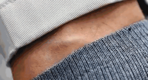 以为是普通感冒,不幸感染去世!医生提醒→ 以为是普通感冒,不幸感染去世!医生提醒→