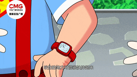 “快救救我们,我老婆被毒蛇咬了!”广西男子紧急求助,他们立即出手 “快救救我们,我老婆被毒蛇咬了!”广西男子紧急求助,他们立即出手