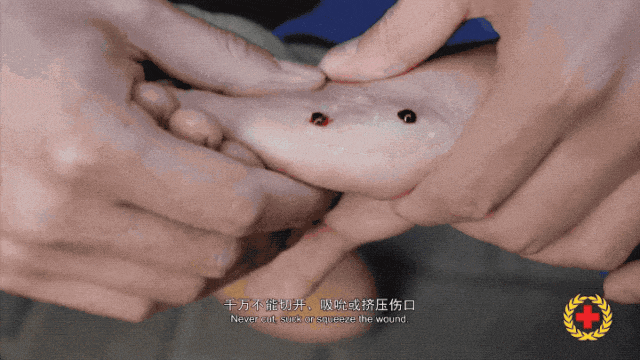 男子散步时脚被蛇咬伤!忍痛拍下蛇的照片,目前伤情…… 男子散步时脚被蛇咬伤!忍痛拍下蛇的照片,目前伤情……