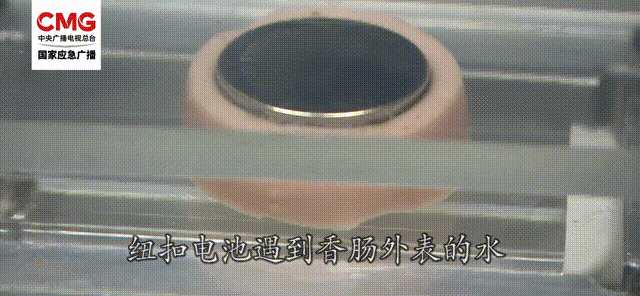 1岁半孩子的食道因TA腐蚀穿孔!家中的“小圆片”快收好 1岁半孩子的食道因TA腐蚀穿孔!家中的“小圆片”快收好