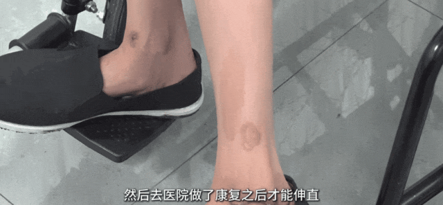 触目惊心！“双腿被毁”仍不知悔改