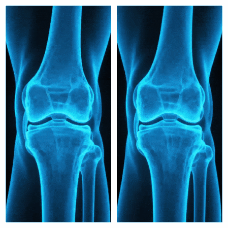 蹲起时关节咔咔响还痛？膝盖最怕的动作，其实是它→