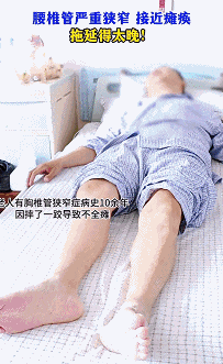 别把腰疼当小事!一种是“越走越疼”,一种是“休息也疼”,辨清病因是关键 别把腰疼当小事!一种是“越走越疼”,一种是“休息也疼”,辨清病因是关键