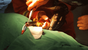 “偷袭”成功！它深深刺入左眼球，将男子送进医院