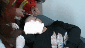 “偷袭”成功！它深深刺入左眼球，将男子送进医院