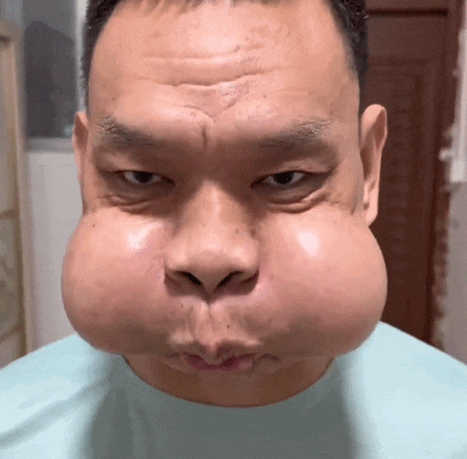 工作30年，男子面部严重变形，形似青蛙！这些职业，正在悄悄改变你的身体