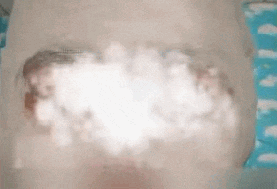 有人差点毁容！有人右眼失明！当心这口家家常用的锅…