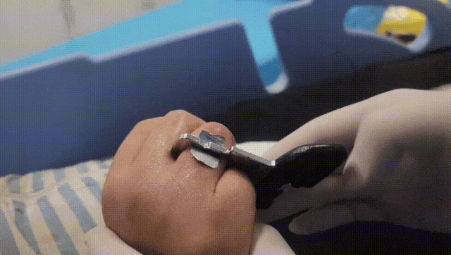 勒出血印!车上这个地方会“咬”孩子手,很多家长都没注意 勒出血印!车上这个地方会“咬”孩子手,很多家长都没注意