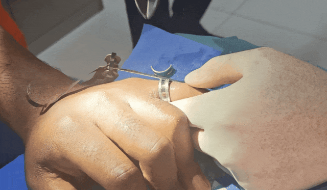 女子这样爱干净,却被紧急送医!“好习惯”用不对会“闯祸” 女子这样爱干净,却被紧急送医!“好习惯”用不对会“闯祸”