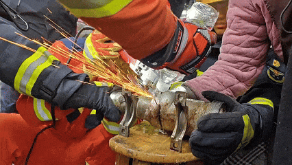 缝纫机“钉”死女子食指，常用机械小心这些致伤风险