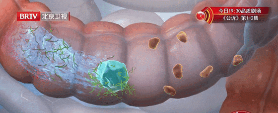 便秘别硬扛，出现这几种情况，可能是癌症信号