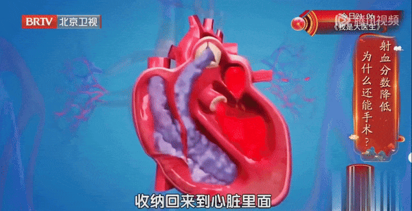心脏偏爱的三类运动，每周坚持练，心脏年轻态更有活力